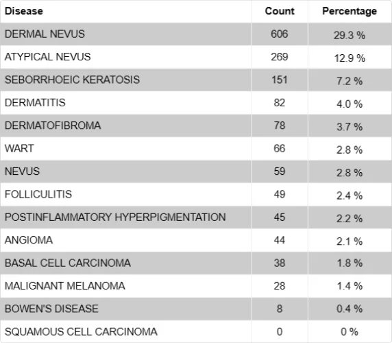 An image of a table showing the skin malignancies and the 10 most common skin conditions identified through the First Derm skin cancer screening platform. The table has three columns: disease, count, and percentage. The data shows that the most common condition is dermal nevus, with 606 cases and 29.3% of the total. The second most common condition is atypical nevus, with 269 cases and 12.9% of the total. The least common conditions are Bowen’s disease and squamous cell carcinoma, with 8 and 0 cases respectively. The table also shows the number and percentage of cases of basal cell carcinoma and malignant melanoma, which are two types of skin cancer.
