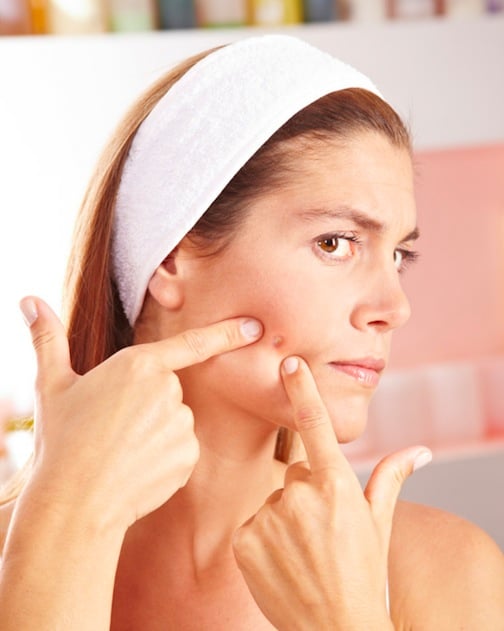 Top Five Acne Misconceptions