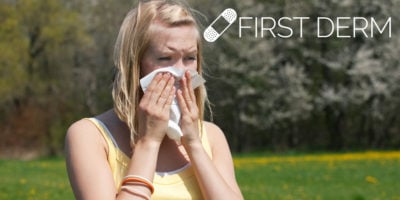 How Do Allergies Work?