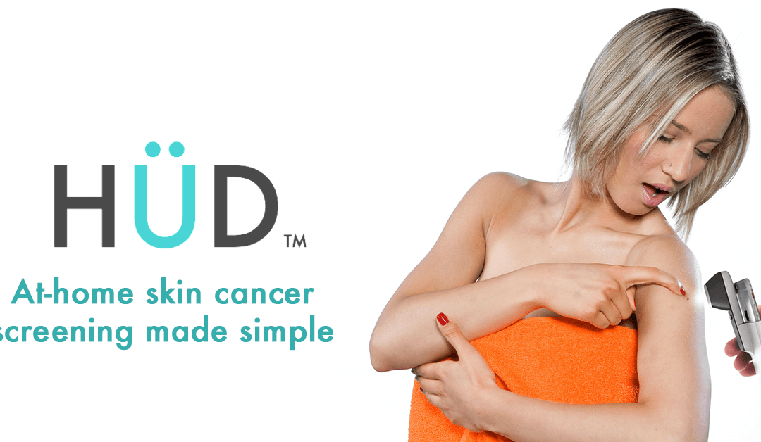 Importance of Dermoscopy for Skin Cancer Screening