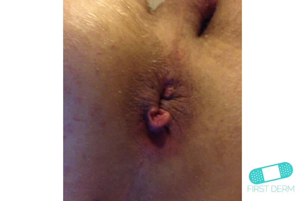 Naruto porno komikslar video