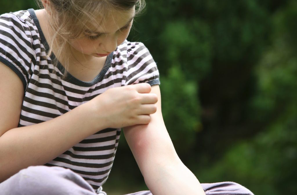 8 Natural Repellents to Prevent Mosquito Bites – During Summer
