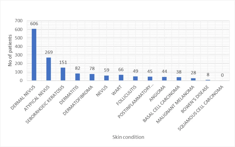 a bar chart showing the skin malignancies and the 10 most common skin conditions identified through the First Derm skin cancer screening platform. The vertical axis represents the count of cases and the horizontal axis represents the disease. The chart has 14 bars of different colors, one for each disease. The bars are arranged from left to right in descending order of count. The highest bar is for dermal nevus, with 606 cases. The second highest bar is for atypical nevus, with 269 cases. The lowest bars are for Bowen’s disease and squamous cell carcinoma, with 8 and 0 cases respectively. The chart also shows the bars for basal cell carcinoma and malignant melanoma, which are two types of skin cancer