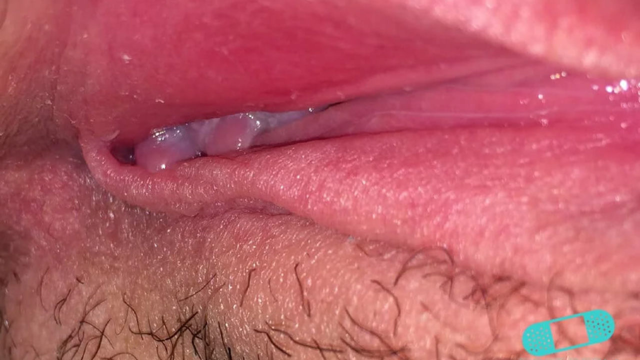 Penis svamp