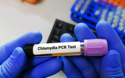 Can Chlamydia Be Transmitted Orally?