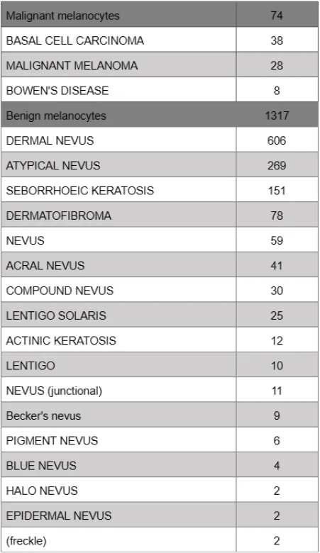 The table is based on the data acquired through First Derm, a skin cancer screening platform. Some examples of the subtypes are basal cell carcinoma, malignant melanoma, Bowen’s disease, dermal nevus, atypical nevus, seborrhoeic keratosis, etc. The table shows that benign melanocyte conditions are much more common than malignant ones, with 1317 cases versus 74 cases