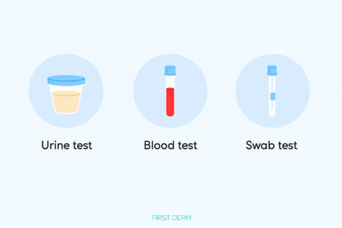 How to Test for an STD: What You Need to Know