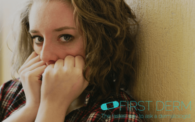 Do I have genital herpes? Use an AI search engine to know